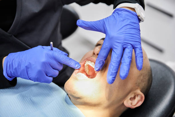 Best Emergency Dental Care for Broken or Chipped Teeth in Charlotte, TN