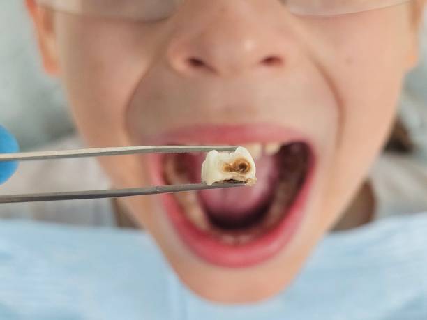 Best Cosmetic Emergency Dentistry in Charlotte, TN